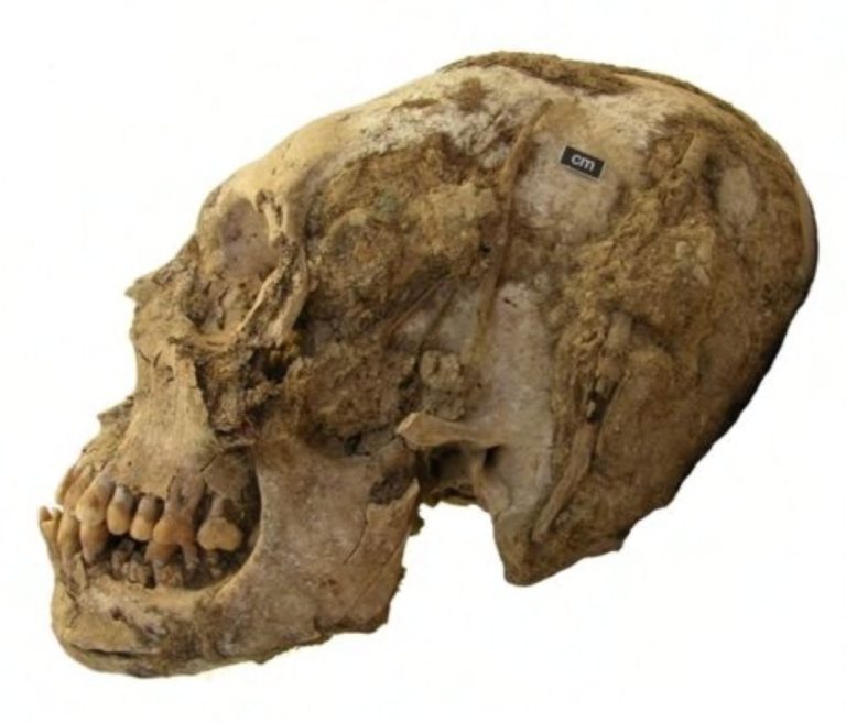 Deformed head.